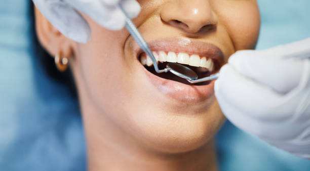 Best Emergency Root Canal Therapy in Hughesville, MD
